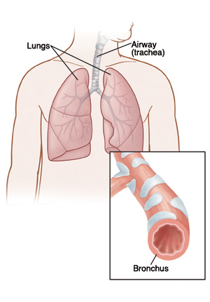 Illustration showing the lungs and a close up view of a bronchial tube (bronchus).
