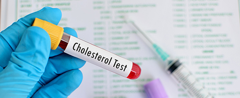 Vial for cholesterol test.